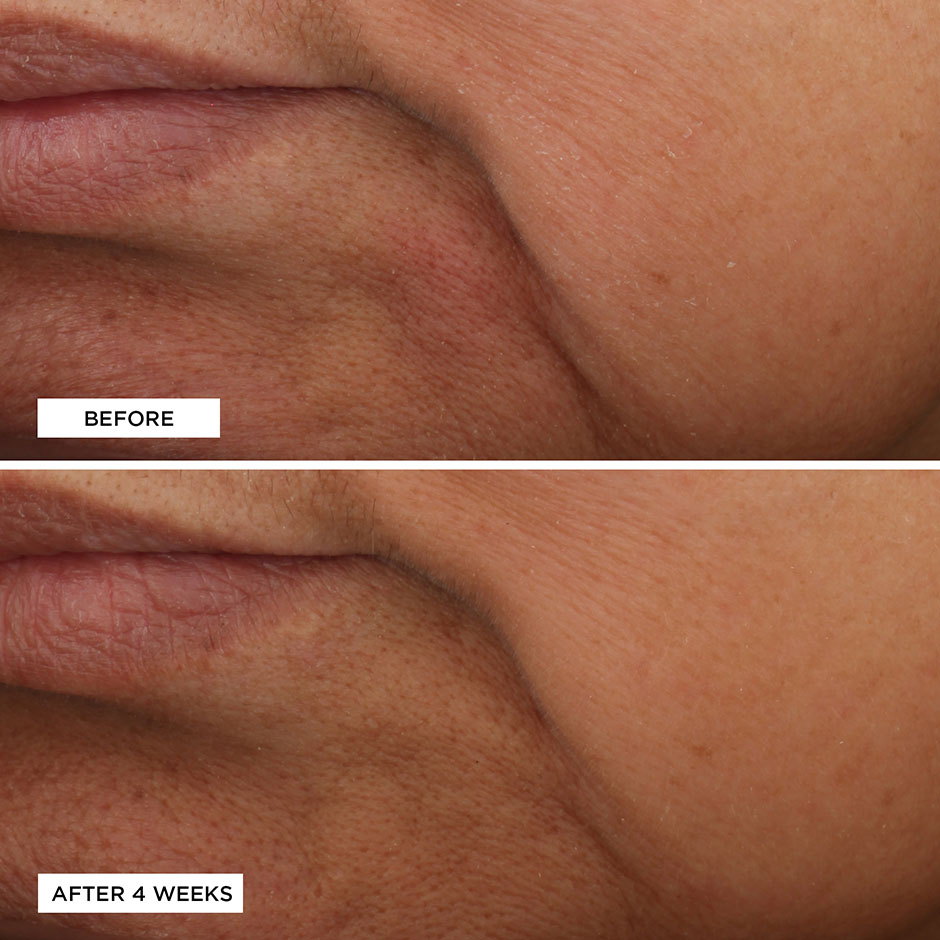 Essential Fx Acyl-Glutathione
